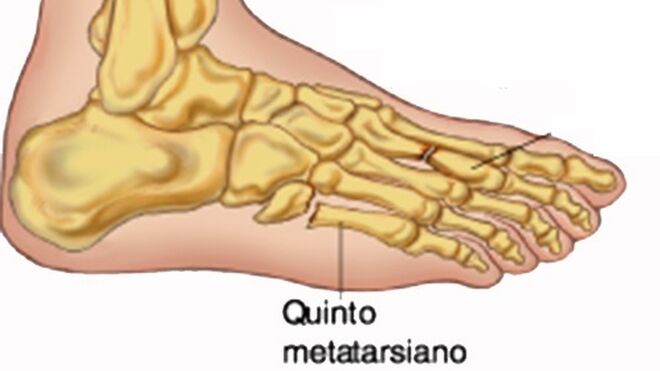 Gráfico de los huesos del pie.