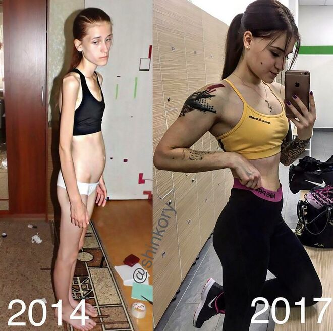 El antes y el después de Vera Schulz