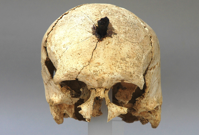Cráneo clavado procedente del Puig de Sant Andreu (Ullastret).