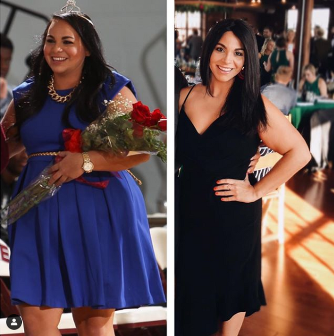 Randi Vasquez, antes y después