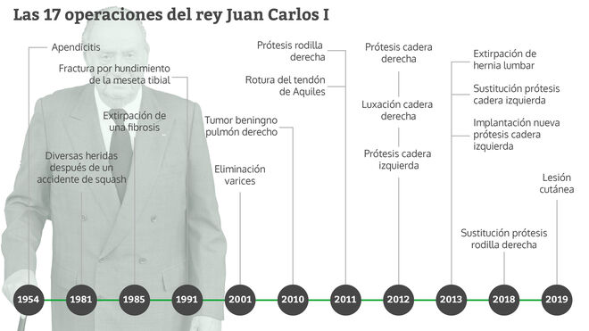 Las 17 operaciones del rey Juan Carlos I