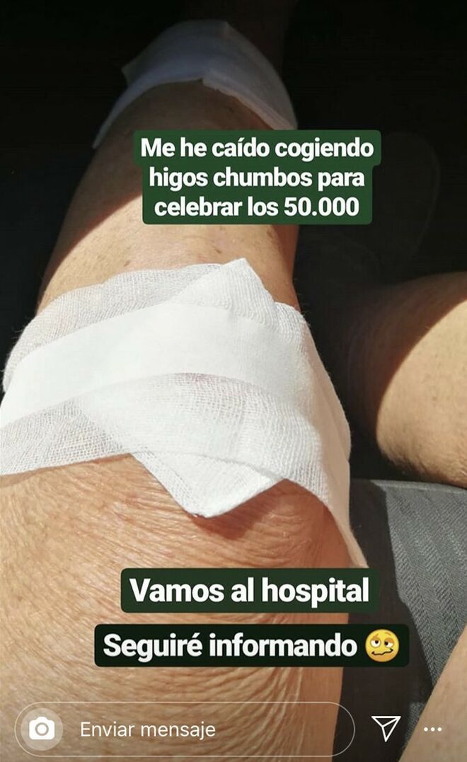 Mercedes Milá cuenta su accidente en Instagram