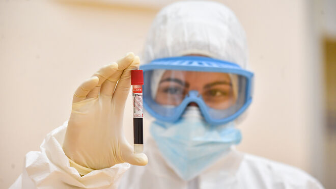 Imagen de un médico con un test de sangre para la detección del coronavirus.