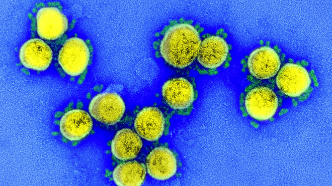 Microfotografía de transmisión de partículas del virus del SARS-CoV-2, aislada de un paciente. Imagen capturada y coloreada en el Centro de Investigación Integrada del NIAID (IRF) en Fort Detrick, Maryland