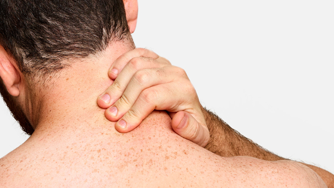 El dolor de cuello puede derivar en migraña