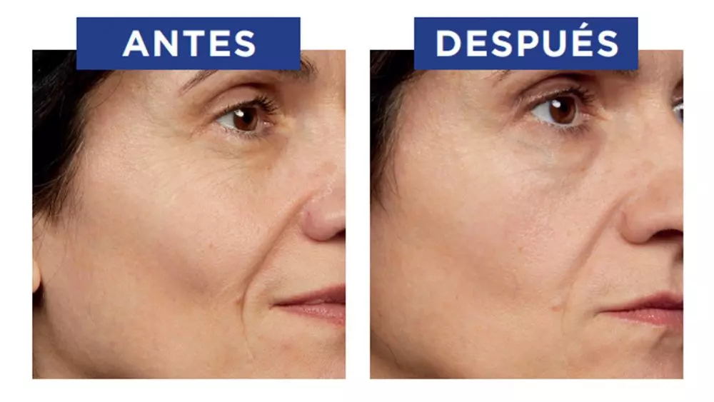 El retinol: la solución antiedad más eficaz para rejuvenecer sin pasar