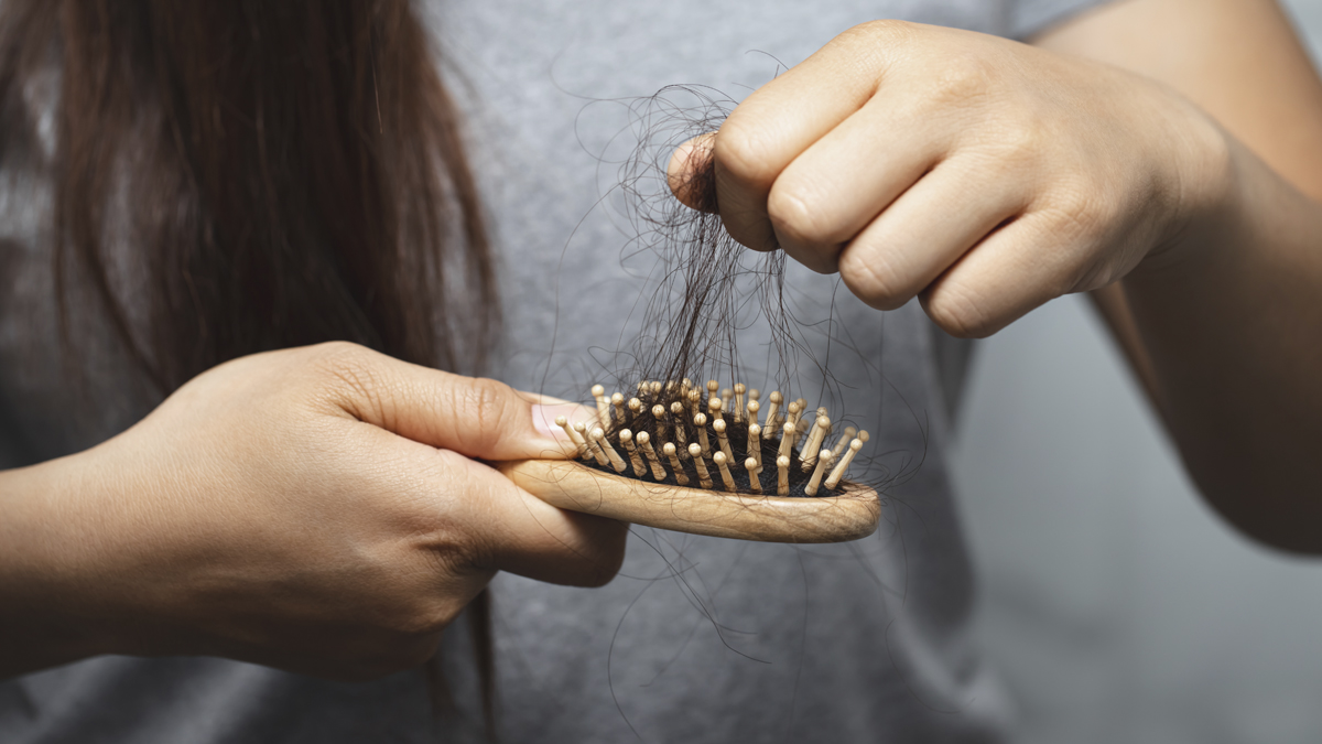 ganancia Compadecerse Operación posible Alopecia femenina: causas, trucos y tratamientos para frenar la caída de  pelo