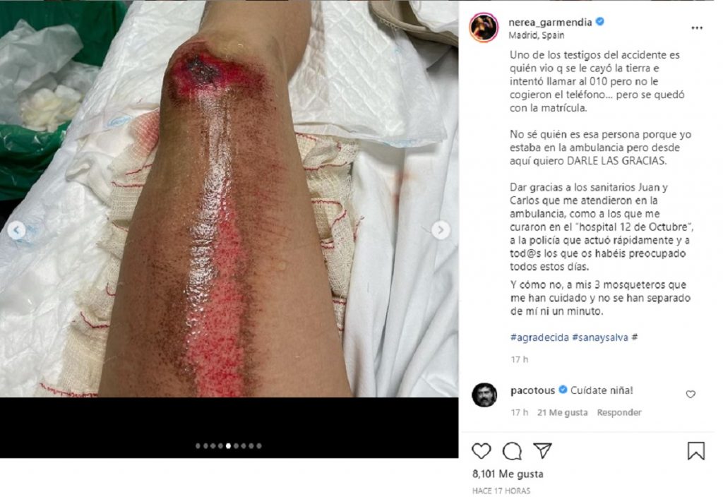 Nerea Garmendia muestra sus heridas tras sufrir un accidente de tráfico