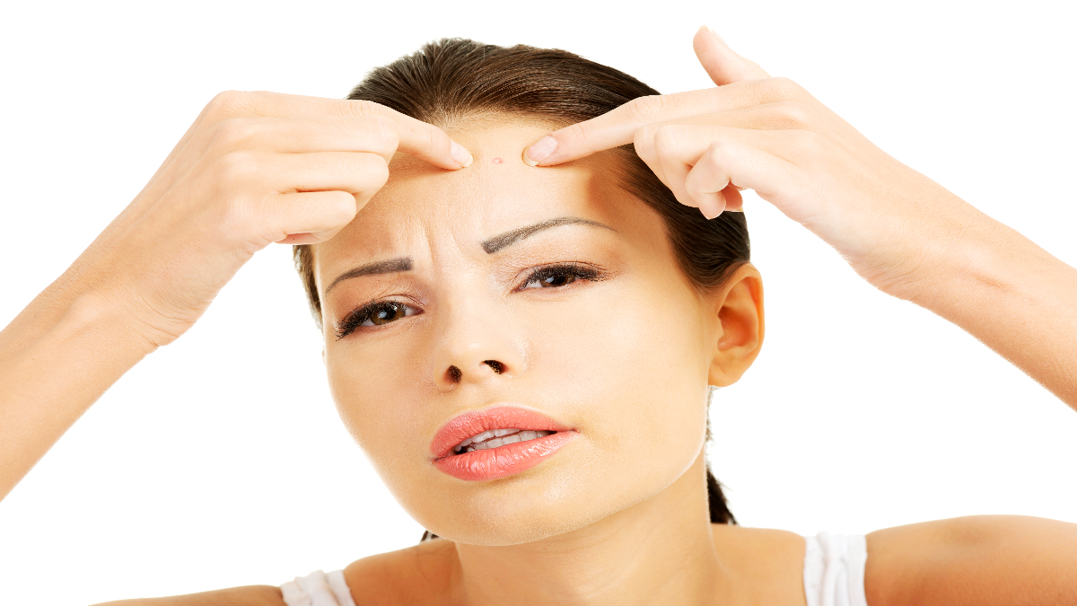 Por qué el estrés favorece la aparición de acné (y qué hacer con esos granos)