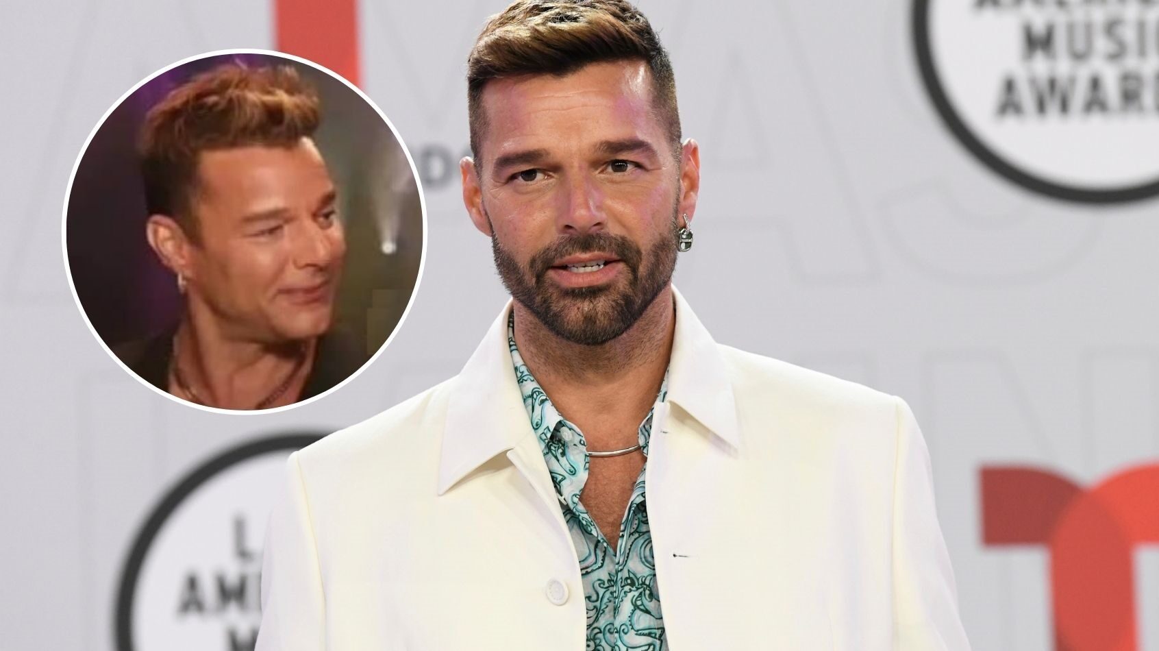 La nueva cara de Ricky Martin provoca una oleada de memes tras su último retoque estético