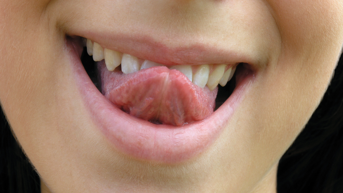 raspado lengua lingual cepillado dientes cepillo higiene dental bucodental
