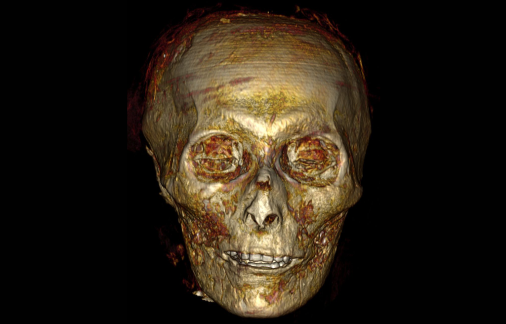 Revelan los secretos de la momia robada por ladrones de tumbas hace 3.000 años 