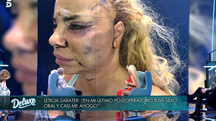 Leticia Sabater muestra las fotos tras la operación