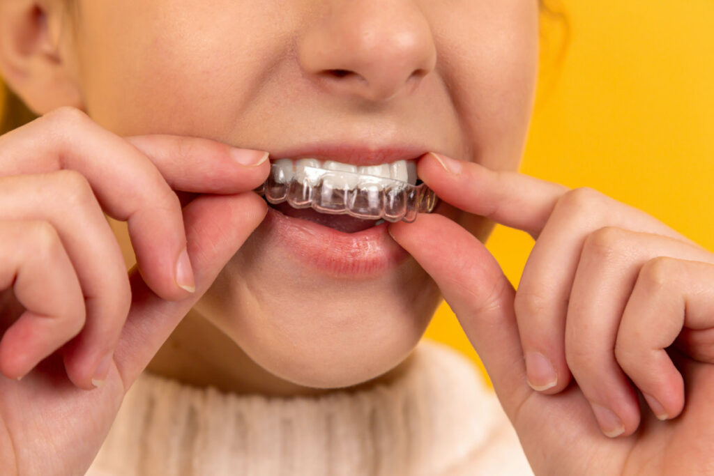 Bruxismo: qué es y cómo evitar este molesto (y problemático) rechinar de dientes