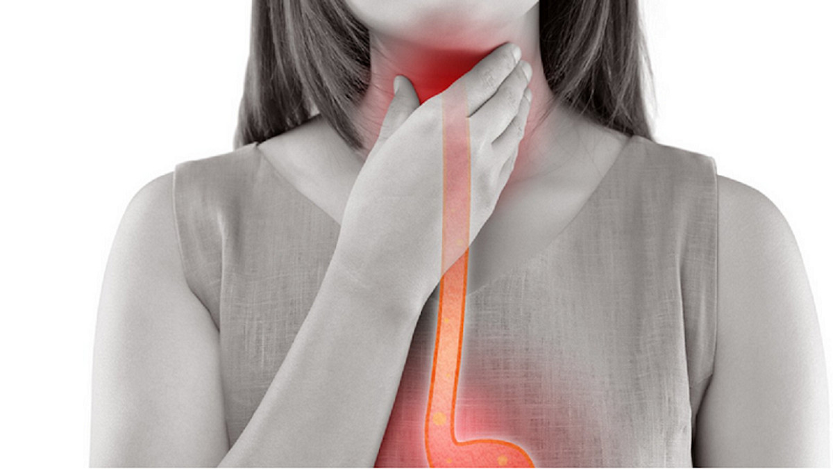 Ocho remedios caseros para aliviar el dolor de garganta de manera natural
