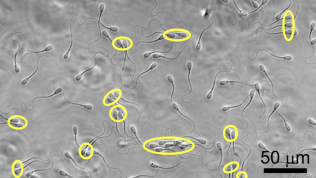 Sperm Swim Better As A Team World Today News