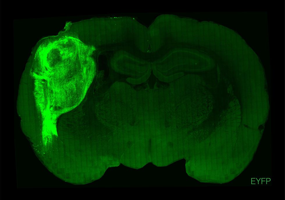 Cerebro de una rata donde se ha incorporado un organoide cerebral humano