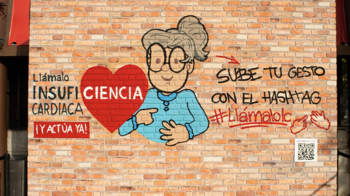 Más del 30% de los españoles con menos de 40 años desconoce en qué consiste la insuficiencia cardiaca