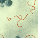 Qué es el estreptococo A, la nueva bacteria que circula entre los menores
