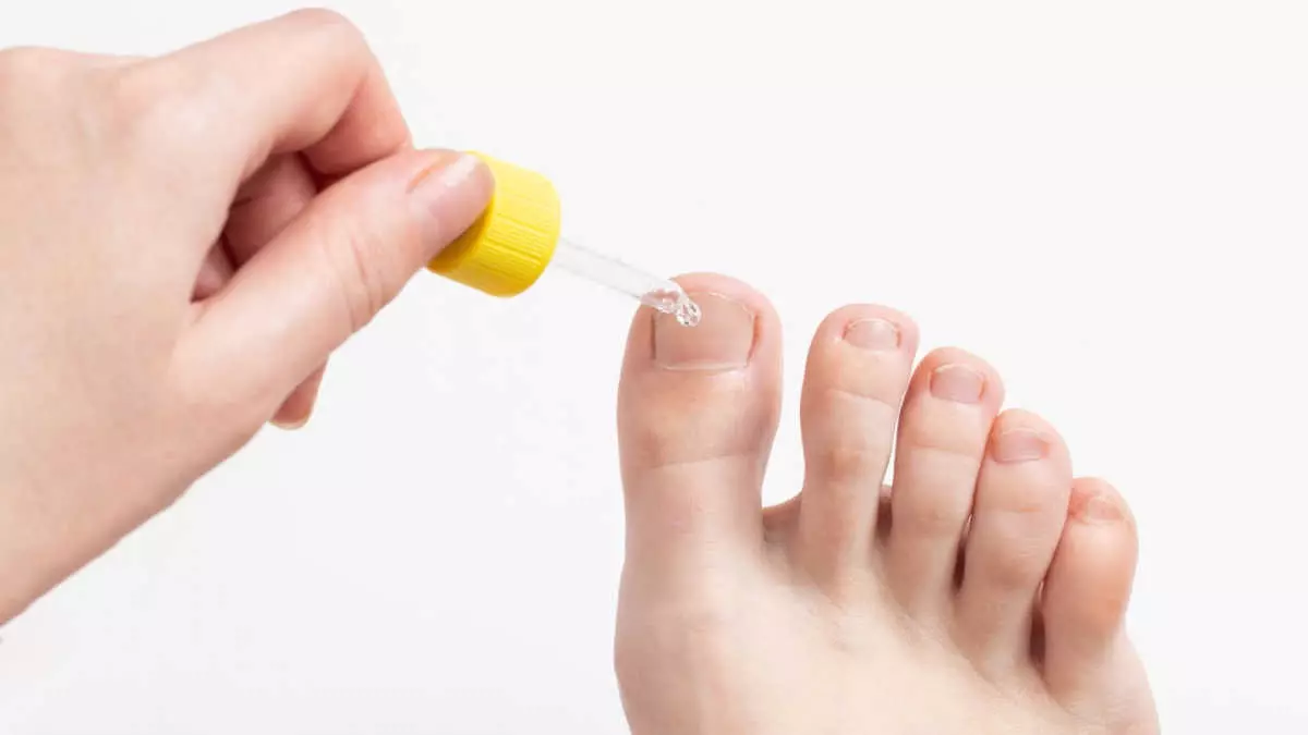 Ya Admirable repentino Los mejores tratamientos para hongos en las uñas de los pies