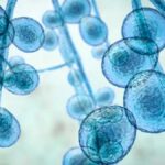 Infecciones por hongos: la pandemia desconocida