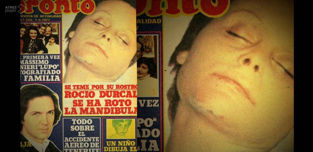 La revista Pronto publicó una foto de Rocío Dúrcal tras ser operada de la mandíbula