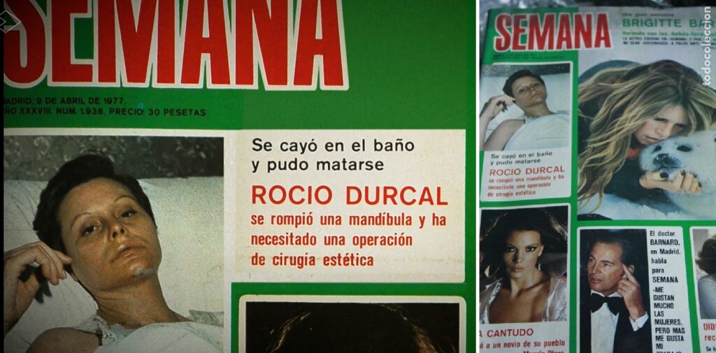 La revista Semana publicó en su portada una foto de Rocío Dúrcal tras romperse la mandíbula con una caída en la bañera