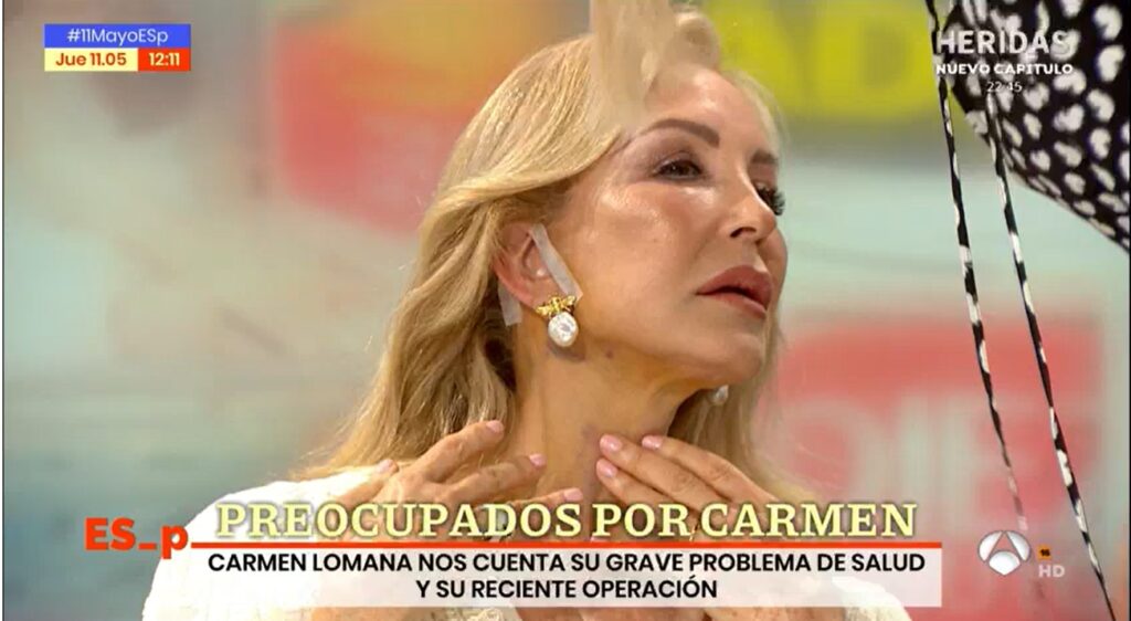 Carmen Lomana muestra la cicatriz tras extirparle un tumor en la carótida