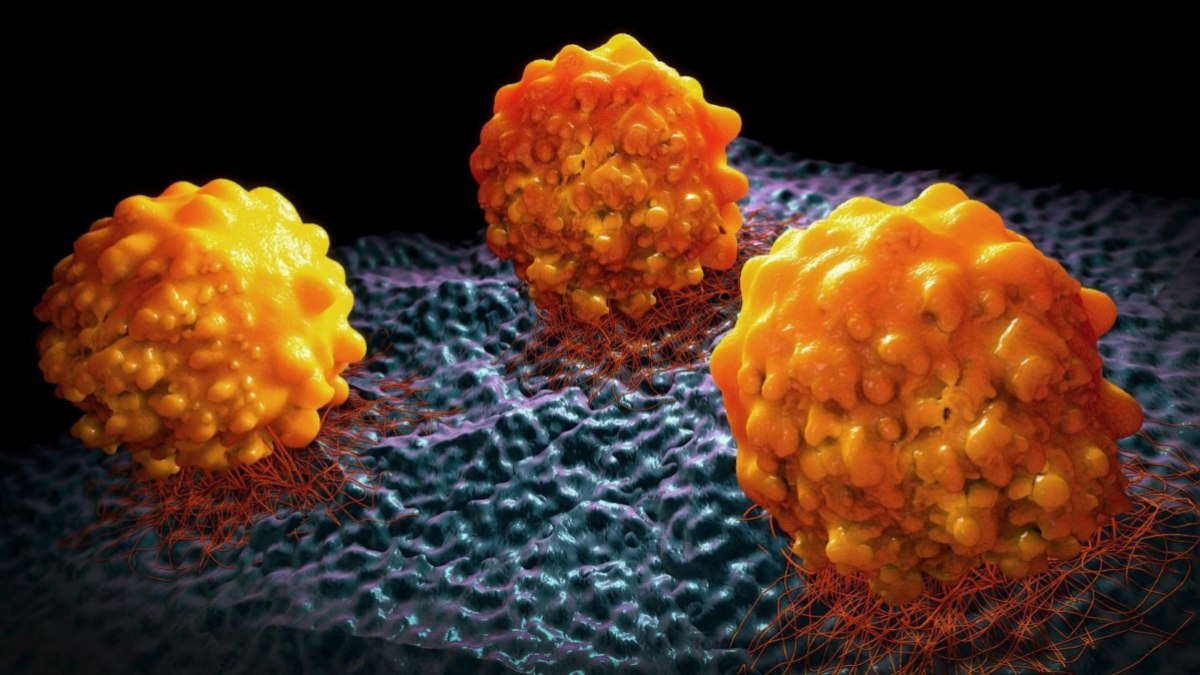 Una vacuna experimental de ARN muestra resultados prometedores en el cáncer de páncreas