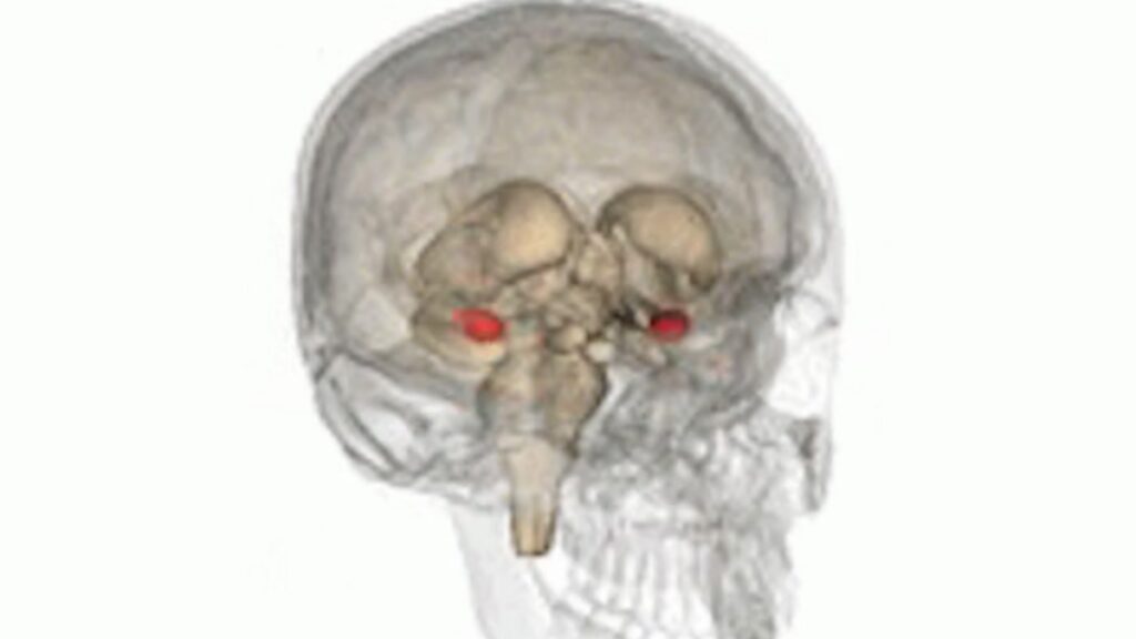 Imagen 3D del cráneo y cerebro con la localización de la amígdala (rojo) necesaria para entender chistes