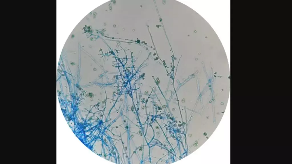 Hifas (filamentos) y esporas de ‘Trichoderma harzianum’ vistas al microscopio