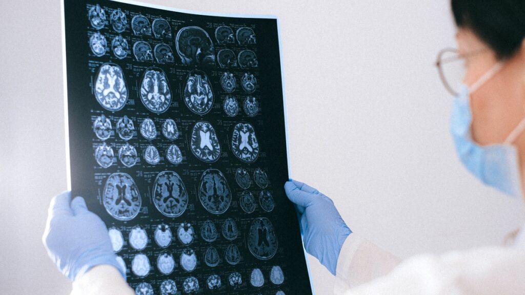 El estudio de Harvard que podría poner fin al alzhéimer