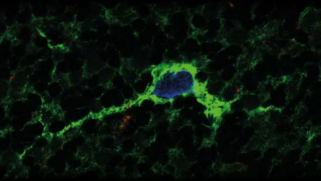 PNN (en verde) rodeando a una neurona de Golgi (azul) en el cerebelo de una rata. El efecto de las drogas en el cerebro