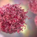 Los ultrasonidos pueden detener el crecimiento de tumores