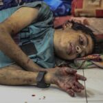 Un niño palestino herido en el Hospital Al Shifa