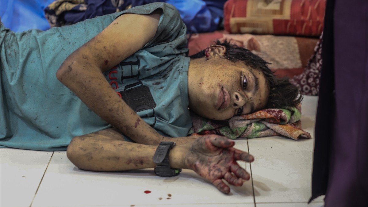 Un niño palestino herido en el Hospital Al Shifa