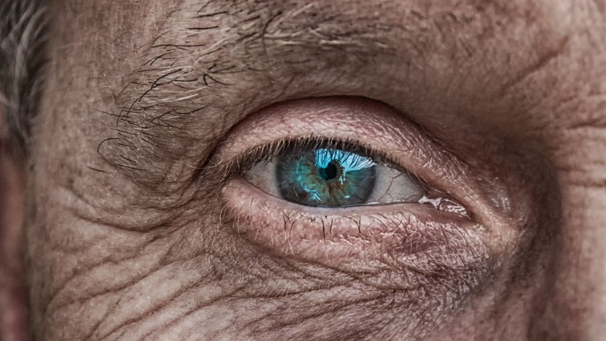 Por qué la hiperpigmentación afecta a más del 90% de la población mayor de 60 años