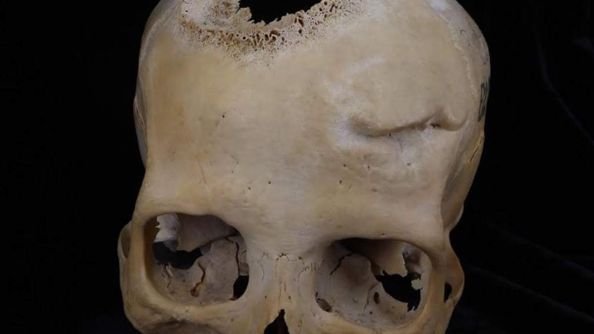 Imagen de un cráneo datado entre el 663 y el 343 a. C. y perteneciente a una mujer de más de 50 años