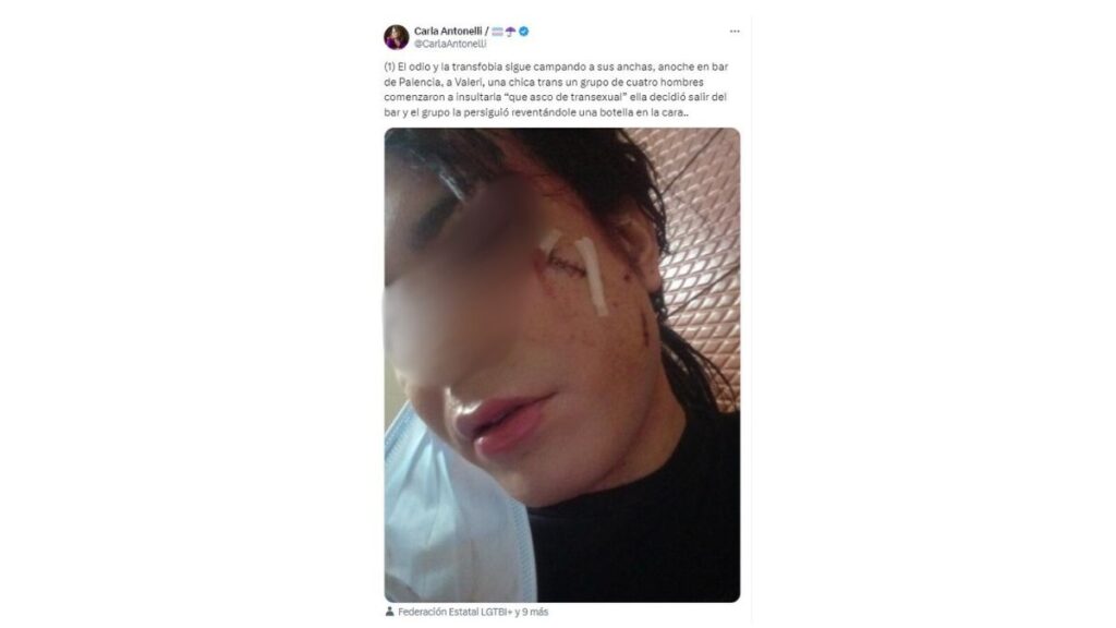 Carla Antonelli denunció la brutal agresión que sufrió esta mujer trans, VC