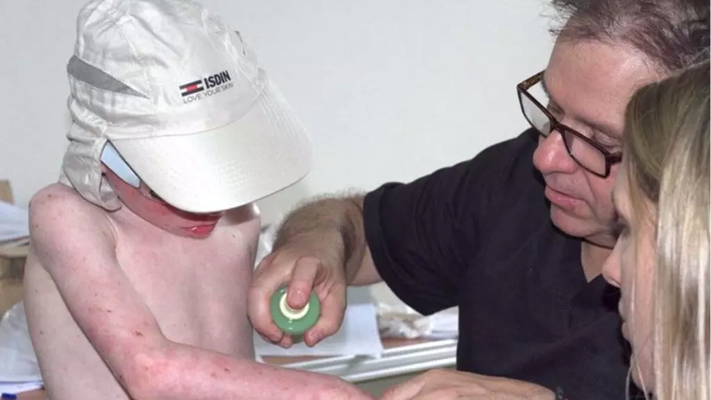 ISDIN extiende su proyecto de ayuda a las personas con albinismo a Panamá, donde está la zona con mayor prevalencia del mundo