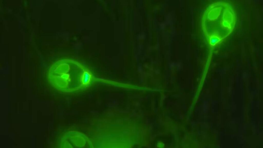 Imagen de microscopía de fluorescencia de esporas del cnidario parásito 'Henneguya salminicola'